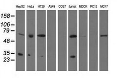 PYCR2 Monoclonal Antibody (OTI2F11), TrueMAB , OriGene:Antibodies:Primary