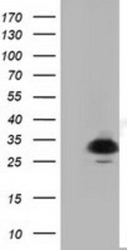 PYCR2 Mouse anti-Human, Clone: OTI2A5, lyophilized, TrueMAB 100 &mu;g;