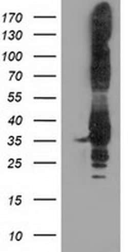 PYCR2 Monoclonal Antibody (OTI5C7), TrueMAB , OriGene 30 &mu;L; Unconjugated:Antibodies,