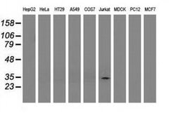 PYCR2 Monoclonal Antibody (OTI5C7), TrueMAB , OriGene:Antibodies:Primary