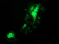 PYCRL Mouse anti-Human, Clone: OTI1C11, lyophilized, TrueMAB 100 &mu;g;