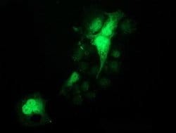 PYCRL Monoclonal Antibody (OTI1C11), TrueMAB , OriGene 100 &mu;L; Unconjugated:Antibodies,
