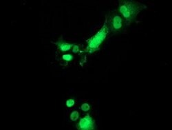 PYCRL Mouse anti-Human, Clone: OTI8H6, lyophilized, TrueMAB 100 &mu;g;
