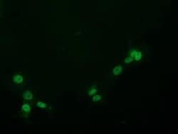 PYCRL Monoclonal Antibody (OTI3B9), TrueMAB , OriGene 100 &mu;L; Unconjugated:Antibodies,