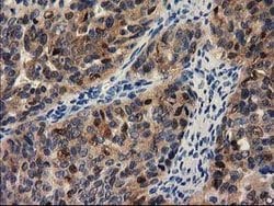 PYCRL Mouse anti-Human, Clone: OTI1C11, lyophilized, TrueMAB 100 &mu;g;