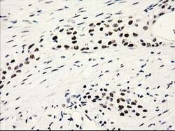 PYCRL Mouse anti-Human, Clone: OTI8H6, lyophilized, TrueMAB 100 &mu;g;
