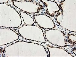 PYCRL Mouse anti-Human, Clone: OTI8H6, lyophilized, TrueMAB 100 &mu;g;