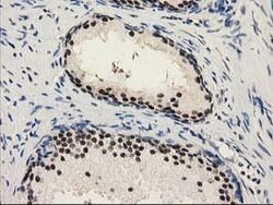 PYCRL Mouse anti-Human, Clone: OTI8H6, lyophilized, TrueMAB 100 &mu;g;