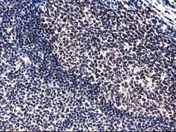 PYCRL Mouse anti-Human, Clone: OTI8H6, lyophilized, TrueMAB 100 &mu;g;