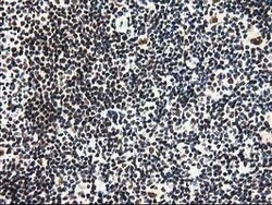 PYCRL Mouse anti-Human, Clone: OTI8H6, lyophilized, TrueMAB 100 &mu;g;