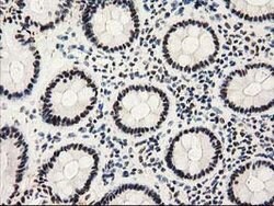 PYCRL Mouse anti-Human, Clone: OTI8H6, lyophilized, TrueMAB 100 &mu;g;