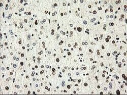 PYCRL Mouse anti-Human, Clone: OTI8H6, lyophilized, TrueMAB 100 &mu;g;