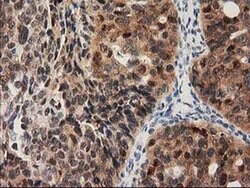 PYCRL Monoclonal Antibody (OTI3B9), TrueMAB , OriGene 100 &mu;L; Unconjugated:Antibodies,