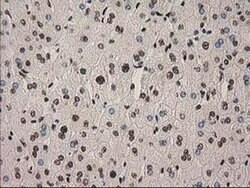 PYCRL Monoclonal Antibody (OTI3B9), TrueMAB , OriGene 100 &mu;L; Unconjugated:Antibodies,