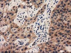 PYCRL Mouse anti-Human, Rat, Clone: OTI1B12, lyophilized, TrueMAB 100 &mu;g;