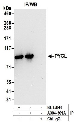 PYGL Rabbit anti-Human, Mouse, Polyclonal, Bethyl Laboratories 100 &mu;L;