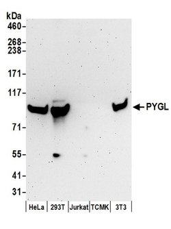 PYGL Rabbit anti-Human, Mouse, Polyclonal, Bethyl Laboratories 100 &mu;L;