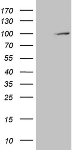 PYGM Monoclonal Antibody (OTI3F9), TrueMAB , OriGene 100 &mu;L; Unconjugated:Antibodies,
