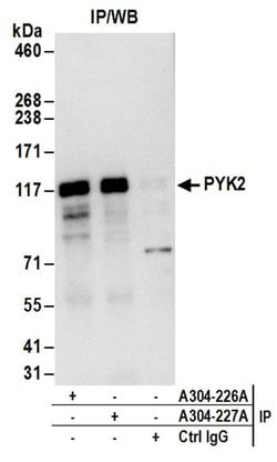 PYK2 Rabbit anti-Human, Polyclonal, Bethyl Laboratories 100 &mu;L; Unconjugated:Antibodies,