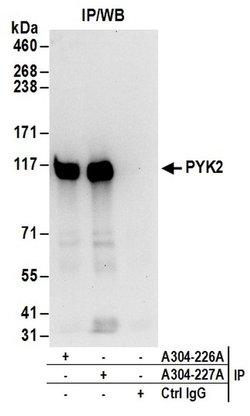 PYK2 Rabbit anti-Human, Polyclonal, Bethyl Laboratories 100 &mu;L; Unconjugated:Antibodies,