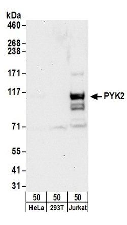 PYK2 Rabbit anti-Human, Polyclonal, Bethyl Laboratories 100 &mu;L; Unconjugated:Antibodies,