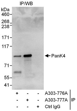 PanK4 Rabbit anti-Human, Polyclonal, Bethyl Laboratories 100 &mu;L | Buy Online | Bethyl Laboratories, Inc | Fisher Scientific