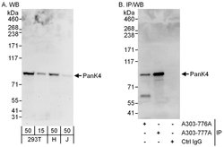 PanK4 Rabbit anti-Human, Polyclonal, Bethyl Laboratories 100 &mu;L; Unconjugated:Antibodies,