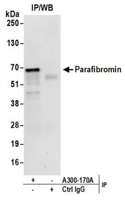 Parafibromin Rabbit anti-Human, Mouse, Polyclonal, Bethyl Laboratories