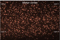 Invitrogen Parvalbumin Polyclonal Antibody 100 &mu;g | Buy Online | Invitrogen&trade; | Fisher Scientific