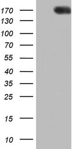 Patched1 Monoclonal Antibody (OTI1H8), TrueMAB , OriGene:Antibodies:Primary