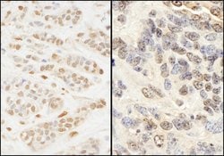 Pc2 Rabbit anti-Human, Mouse, Polyclonal, Bethyl Laboratories 100 &mu;L;