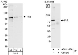 Pc2 Rabbit anti-Human, Mouse, Polyclonal, Bethyl Laboratories 100 &mu;L;
