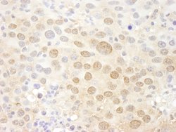 Pc2 Polyclonal Antibody, Bethyl Laboratories 10 &mu;L; Unconjugated:Antibodies,