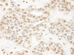Pc2 Polyclonal Antibody, Bethyl Laboratories:Antibodies:Primary Antibodies