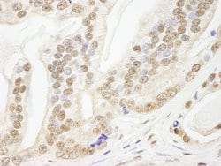 Pds5B Polyclonal Antibody, Bethyl Laboratories 100 &mu;L; Unconjugated:Antibodies,