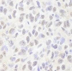 Pds5B Polyclonal Antibody, Bethyl Laboratories:Antibodies:Primary Antibodies
