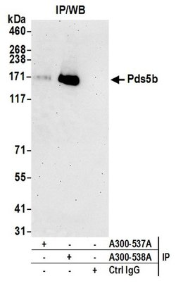 Pds5B Polyclonal Antibody, Bethyl Laboratories 20 &mu;L; Unconjugated:Antibodies,