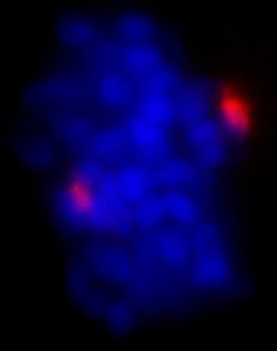 Pericentrin/Kendrin Polyclonal Antibody, Bethyl Laboratories 100 &mu;l;