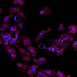 Invitrogen Perilipin 1 Polyclonal Antibody, Alexa Fluor 647 50 &mu;g; Alexa