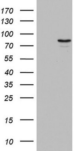 Periostin Monoclonal Antibody (OTI2D10), TrueMAB , OriGene:Antibodies:Primary