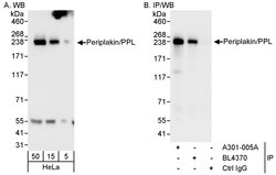 Periplakin/PPL Rabbit anti-Human, Mouse, Rat, Polyclonal, Bethyl Laboratories