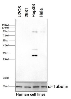 Invitrogen Phospho-GYS1 (Ser641, Ser645) Polyclonal Antibody 100 &mu;L;