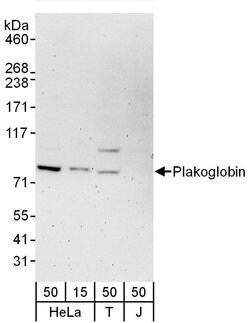 Plakoglobin Rabbit anti-Human, Polyclonal, Bethyl Laboratories 100 &mu;L;