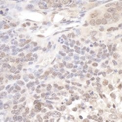 Pol Lambda Rabbit anti-Human, Mouse, Polyclonal, Bethyl Laboratories 100