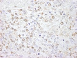 Pol Lambda Polyclonal Antibody, Bethyl Laboratories 100 &mu;L; Unconjugated:Antibodies,