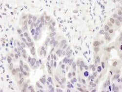 PolD2 Rabbit anti-Human, Polyclonal, Bethyl Laboratories 100 &mu;L; Unconjugated:Antibodies,