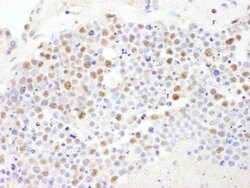 PolD3/p66 Rabbit anti-Human, Polyclonal, Bethyl Laboratories 10 &mu;L;