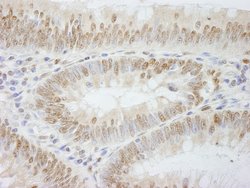 PolE3/p17 Polyclonal Antibody, Bethyl Laboratories 100 &mu;l; Unlabeled:Antibodies,