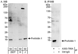 Prefoldin 1 Rabbit anti-Human, Polyclonal, Bethyl Laboratories 100 &mu;L | Buy Online | Bethyl Laboratories, Inc | Fisher Scientific