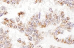 Presenilin-2 Rabbit anti-Human, Polyclonal, Bethyl Laboratories 100 &mu;L;